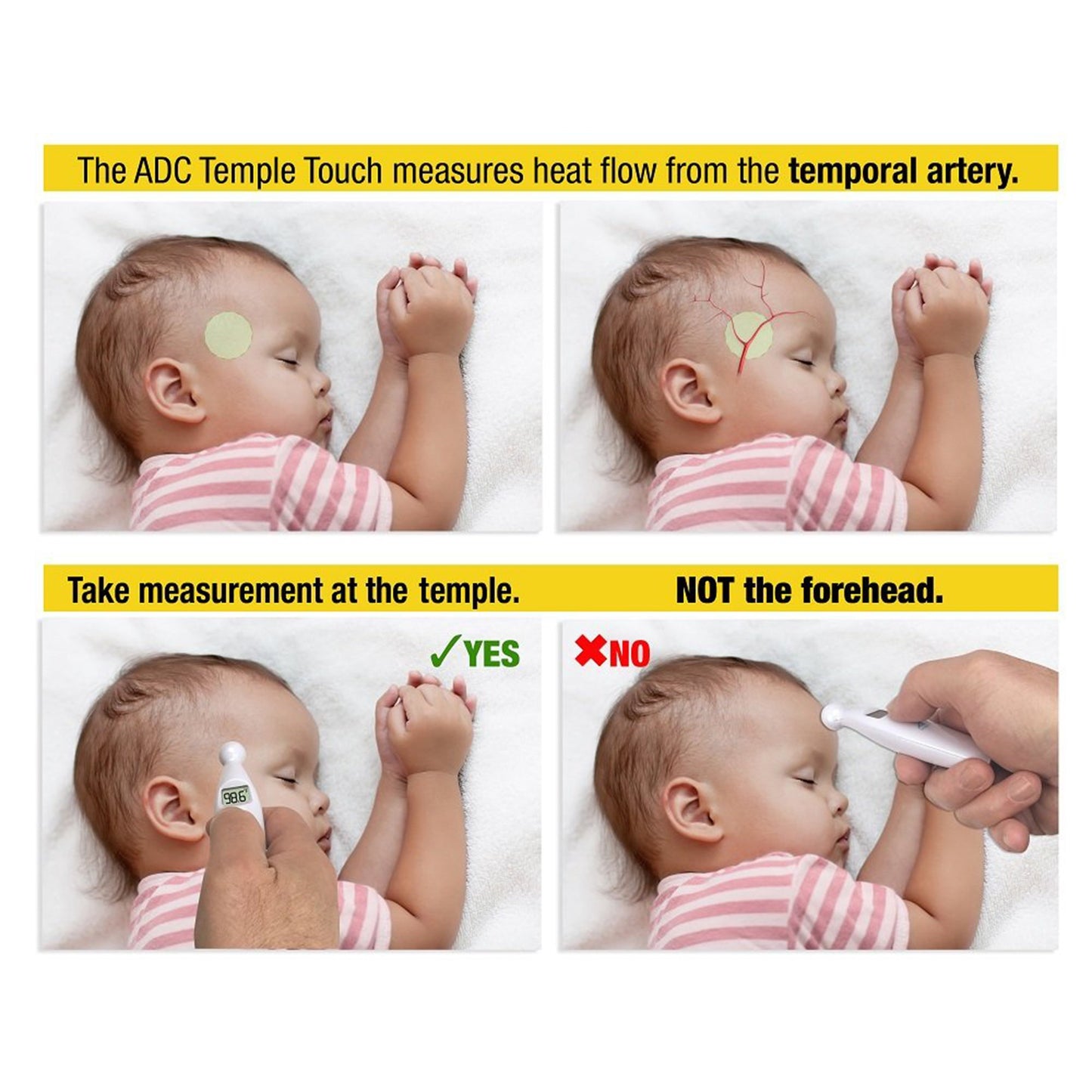 Temporal Contact Thermometer Adtemp™ 427 Temporal Probe Handheld