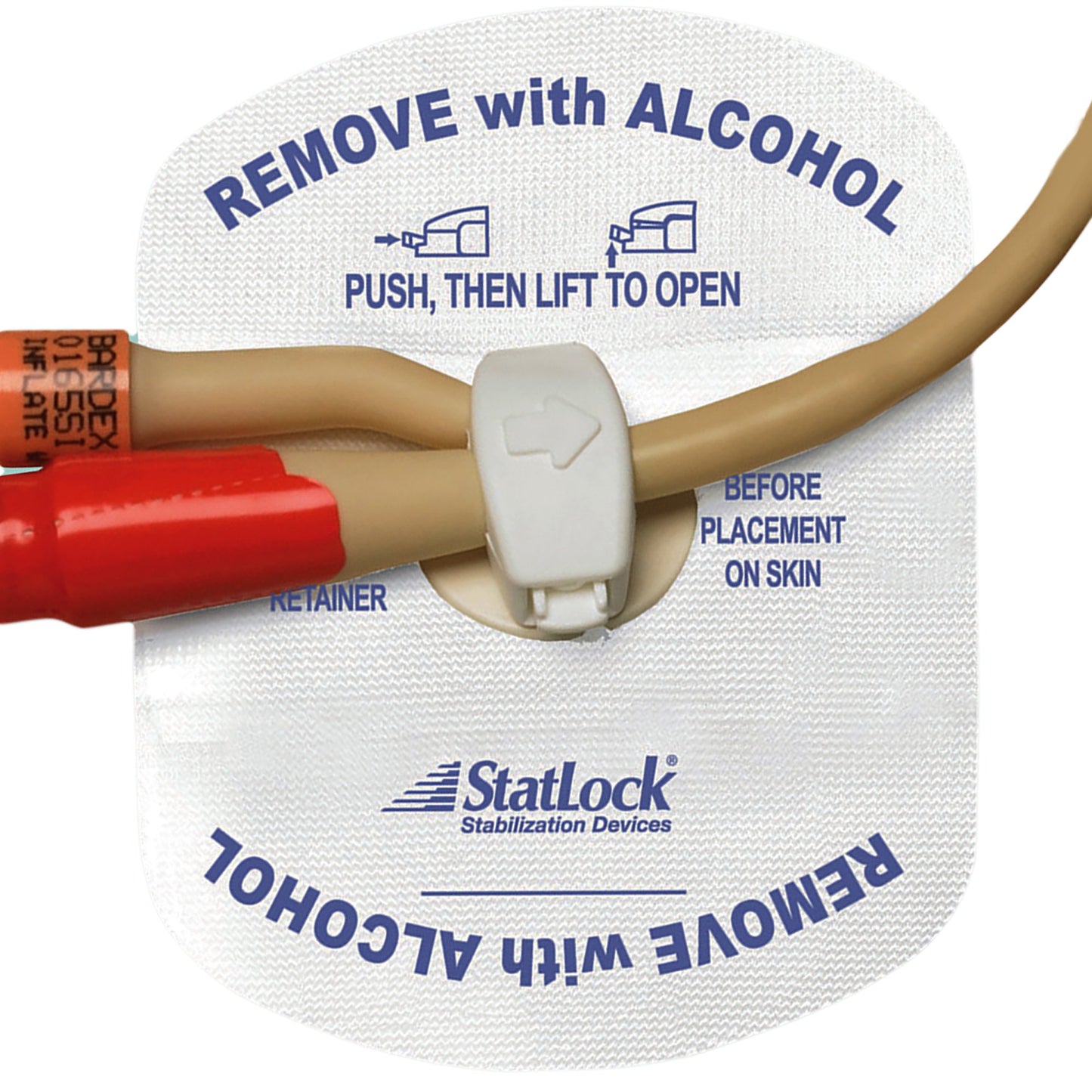 statlock foley stabilizer white. removel with alcohol. With stabilizing device to hold catheter in place